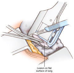 Thoracic_6-5